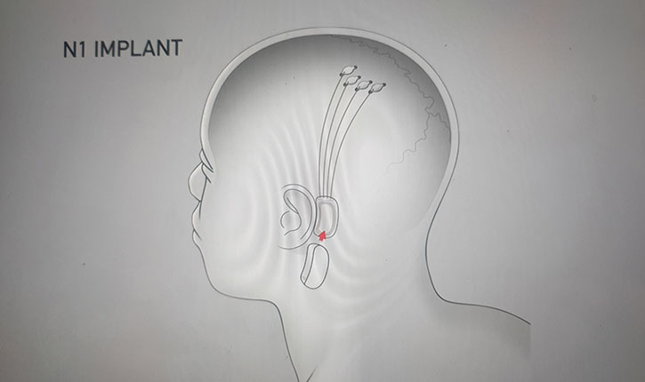 Brain on Chip