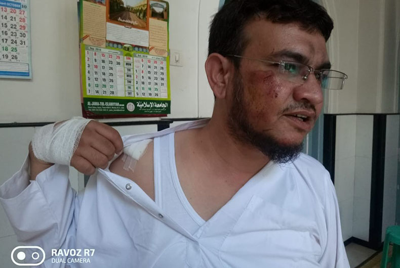 Naveed Mirza Injured in dog attack