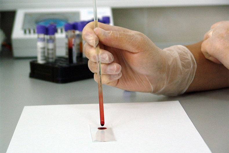 New Blood Test