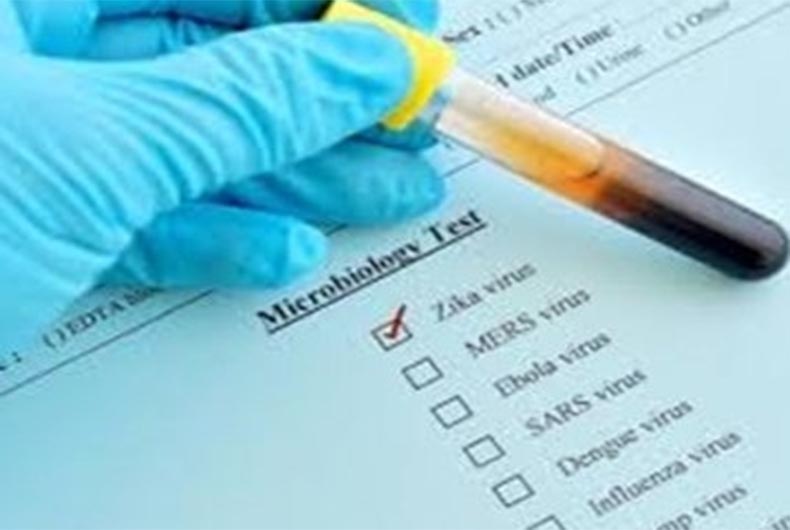 1st case of Zika virus in Raichur, Karnataka on health alert