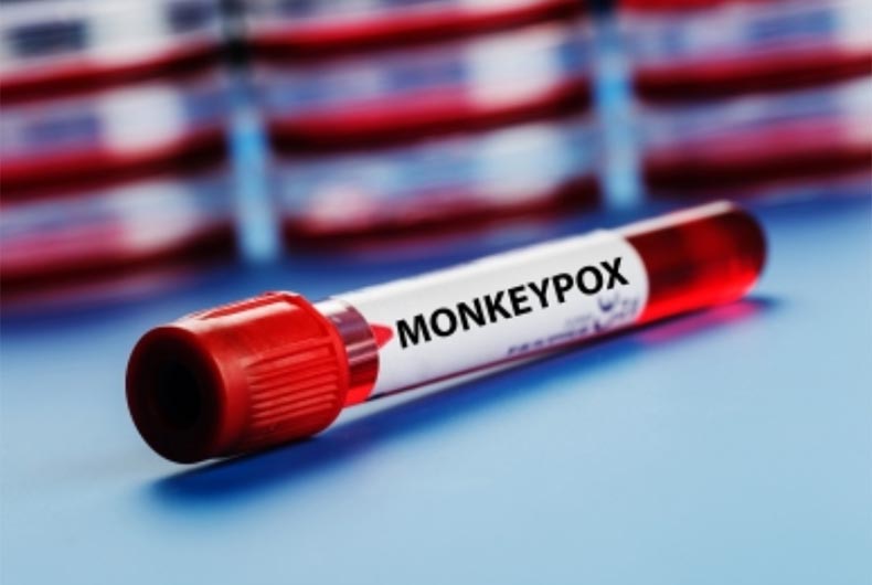 Hyderabad Monkeypox