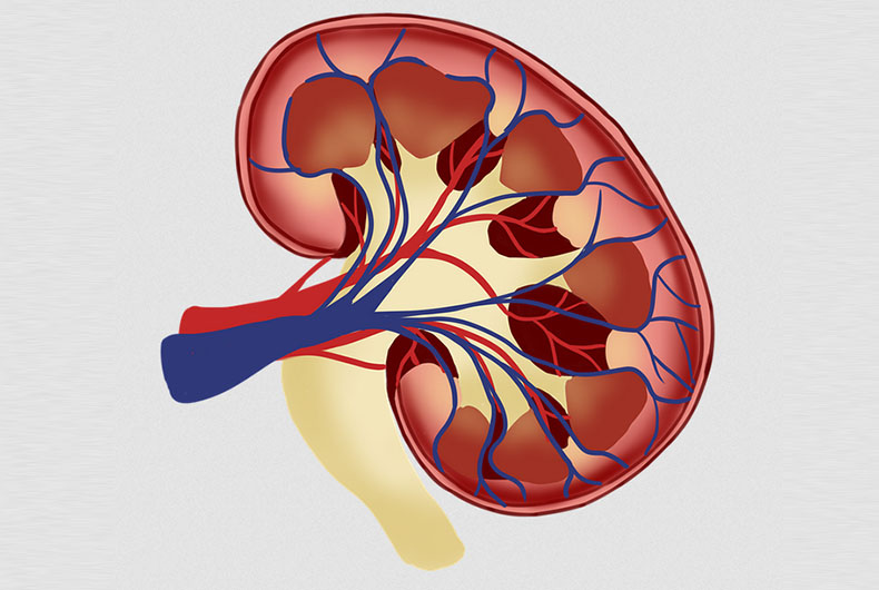Kidney Treatment
