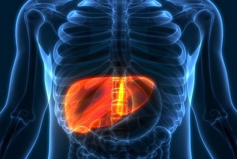 Hepatitis