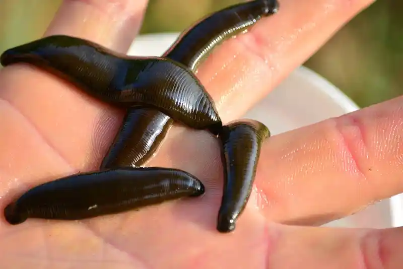 Leech Therapy