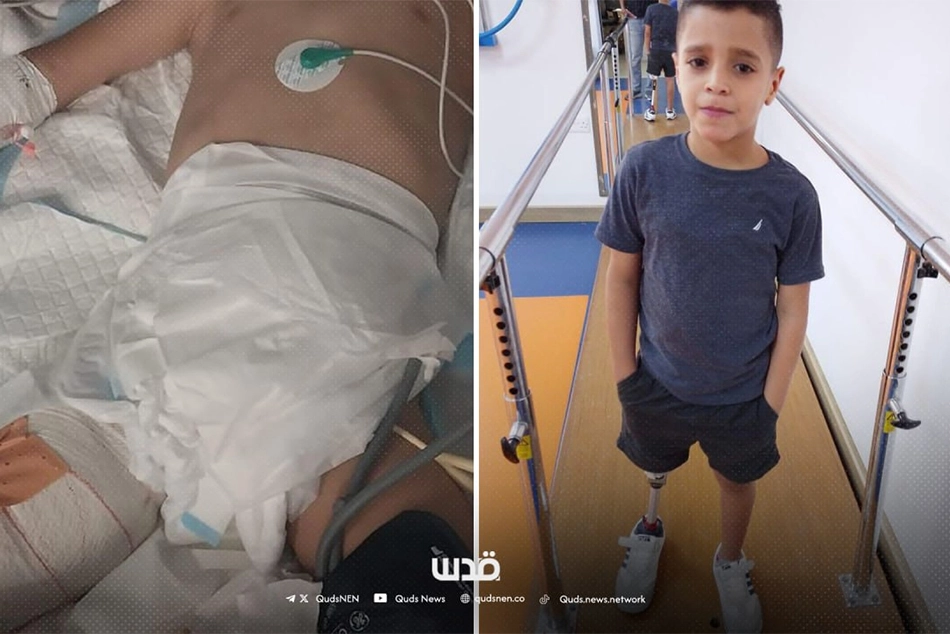 Children Carrying Heaviest Burden of Israel’s Genocide in Gaza