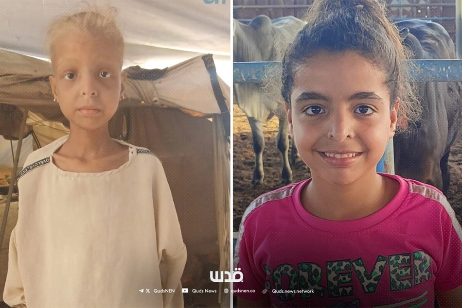 Children Carrying Heaviest Burden of Israel’s Genocide in Gaza