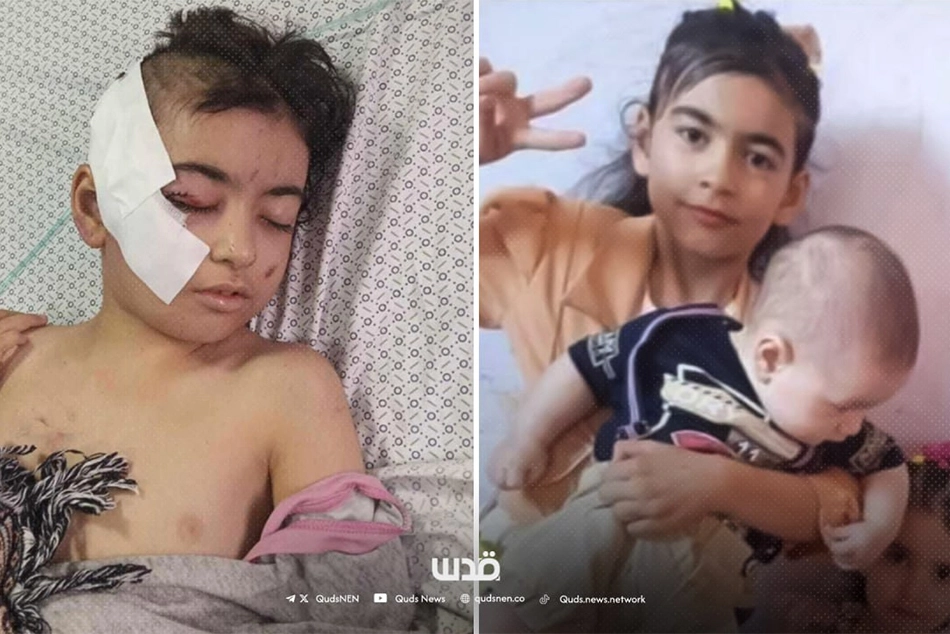 Children Carrying Heaviest Burden of Israel’s Genocide in Gaza